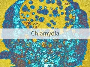 Chlamydia Information
