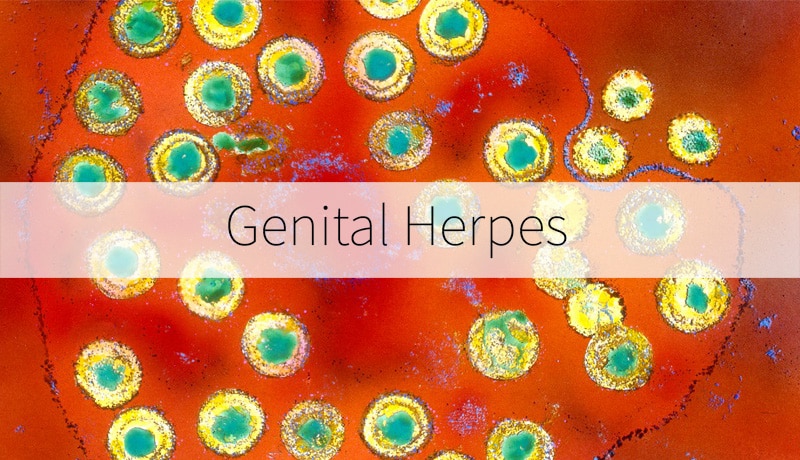 Herpes Information