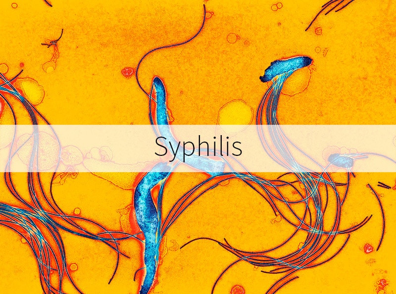 Syphilis information