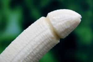 Circumcision Reduce STD Diseases In Africa Image