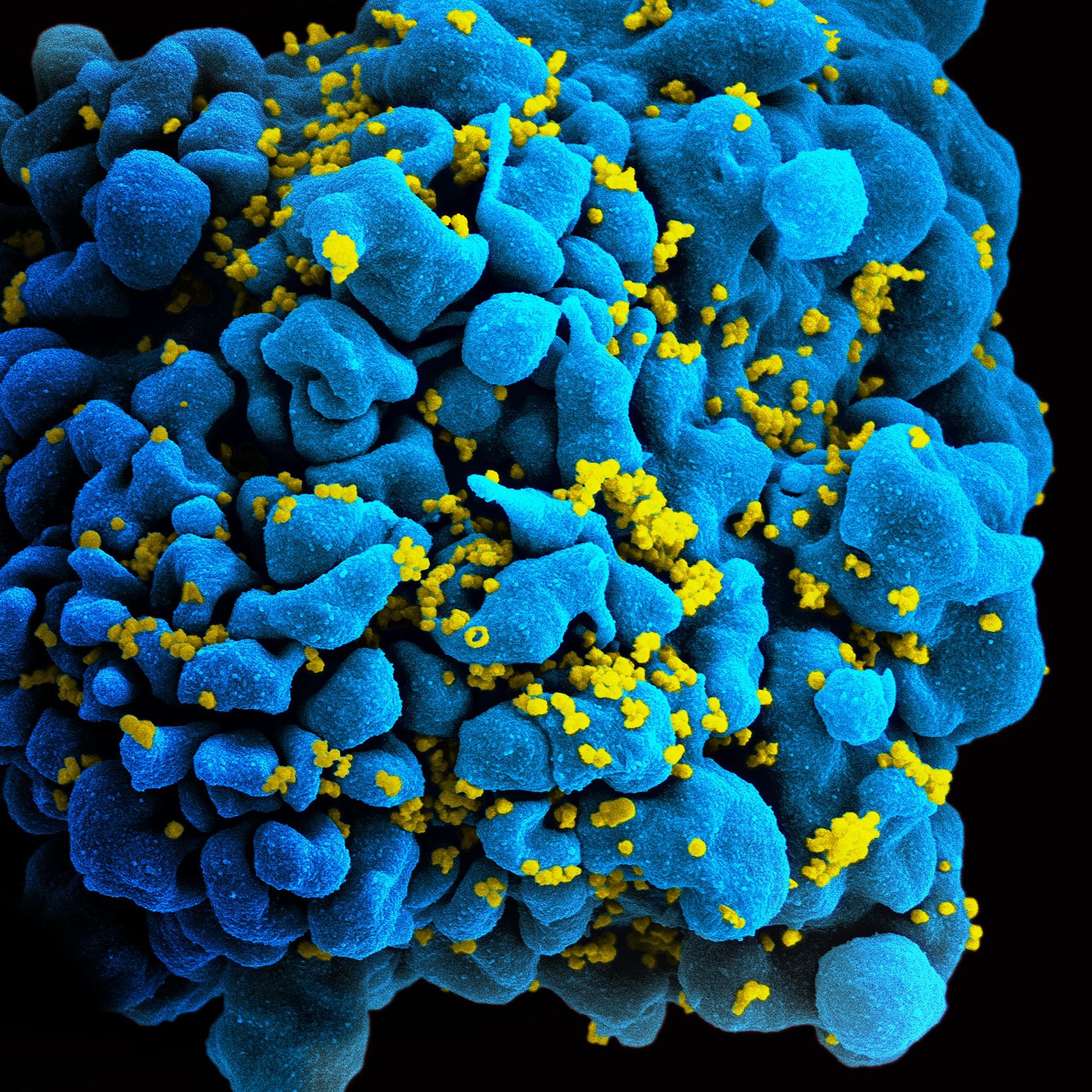 Drug-Resistant HIV on the Rise, WHO Warns Image