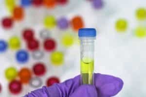 Everything You Need to Know About Chlamydia PCR Image