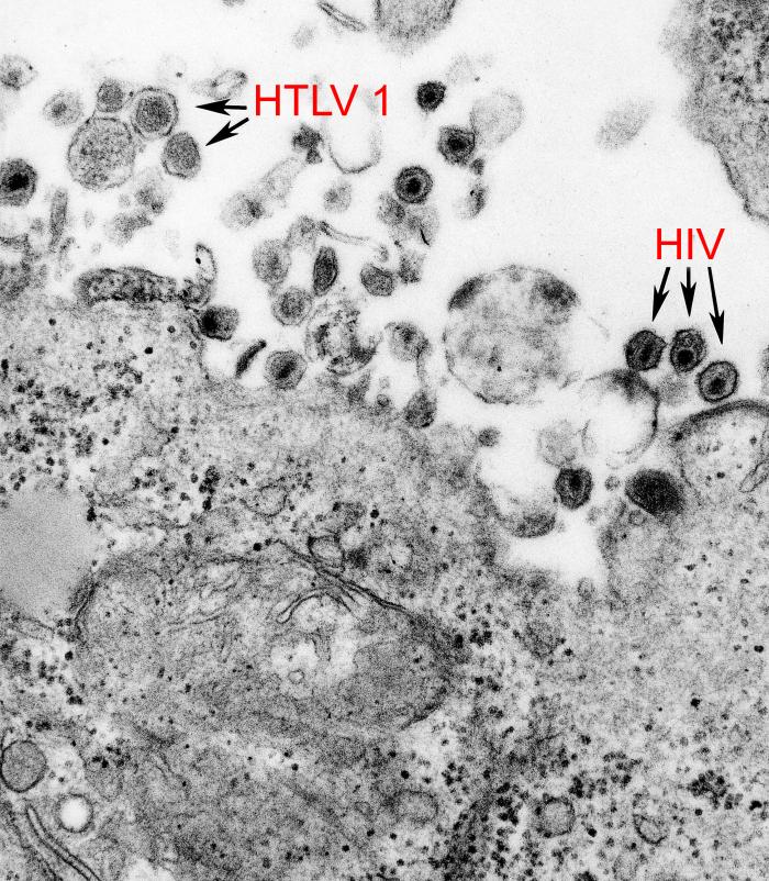 HTLV (Type 1 and 2) in Africa Image