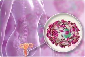 Vaginosis Treatment in Africa Image