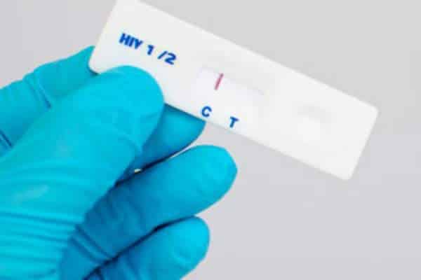 HIV Infection and Testing