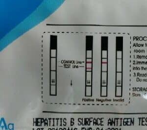 Hepatitis B One Step Private Test