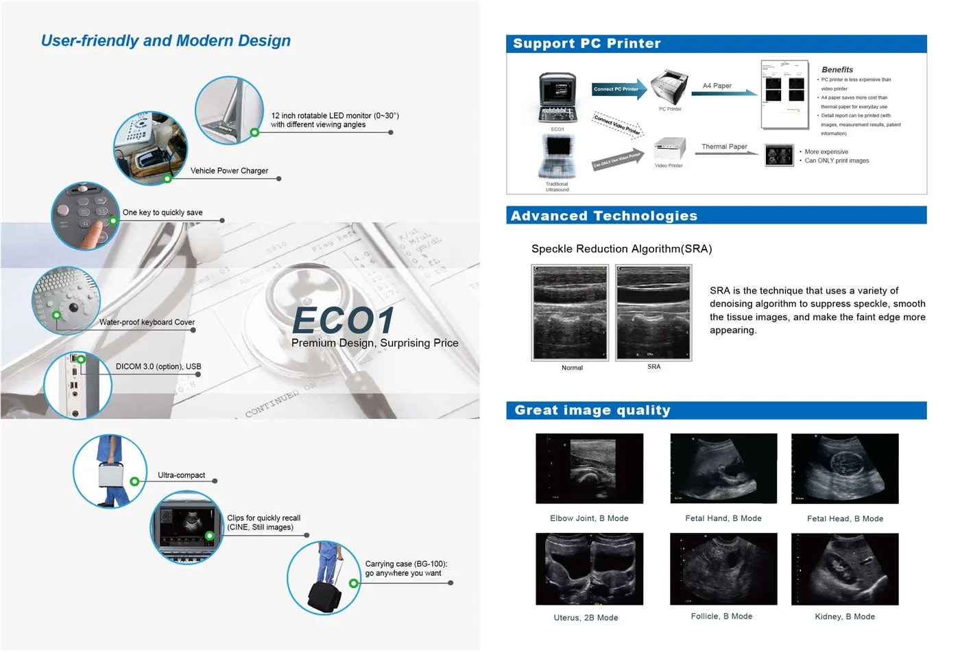 Chison Eco1 Ultrasound Machine - Image 4
