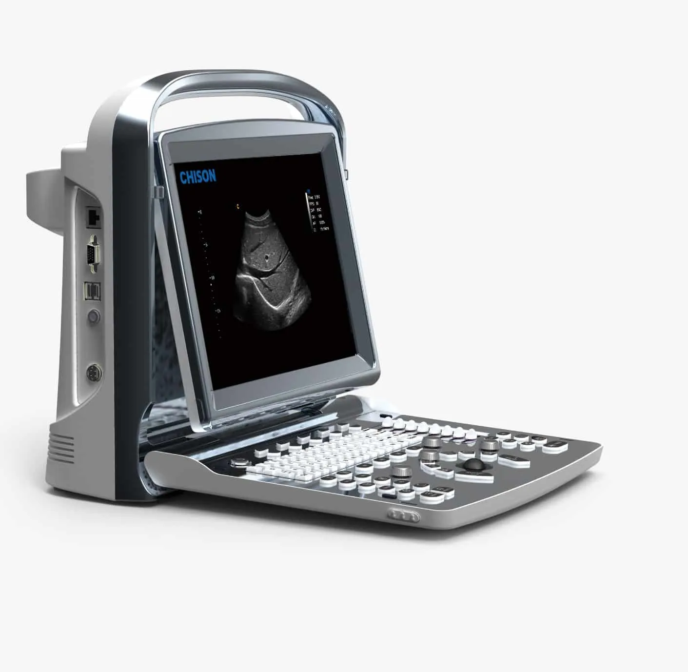 Chison Eco1 Ultrasound Machine - Image 2