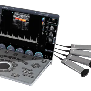 New SonoAir30 Laptop-Based Ultrasound System