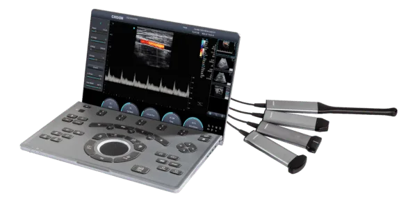 New SonoAir30 Laptop-Based Ultrasound System