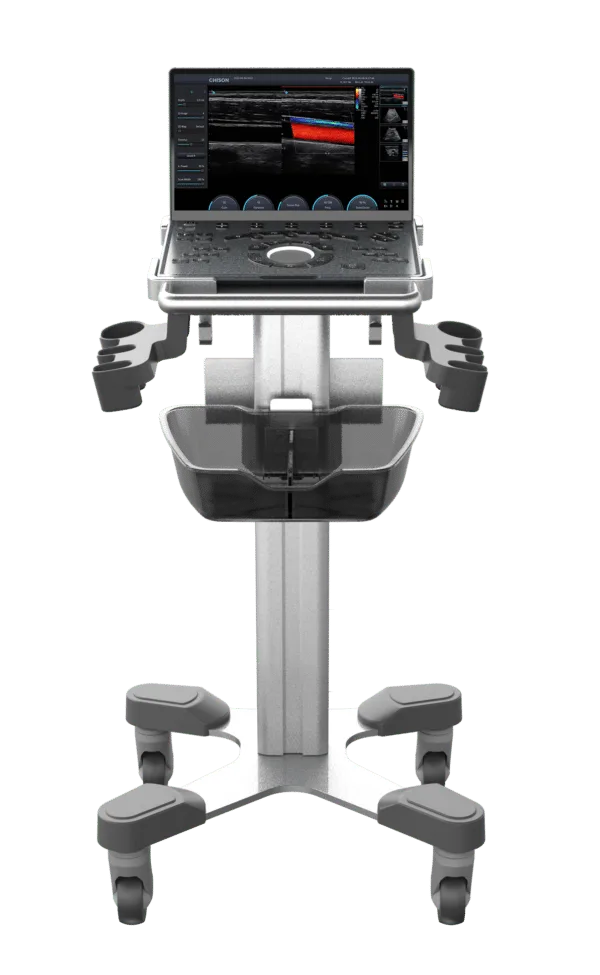 New SonoAir30 Laptop-Based Ultrasound System - Image 2