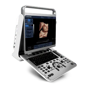 Chison EBit30 Ultrasound Machine