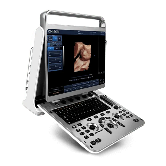 Chison EBit30 Ultrasound Machine