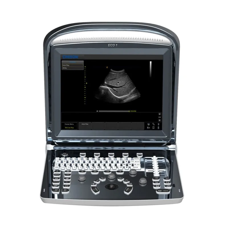Chison Eco1 Ultrasound Machine