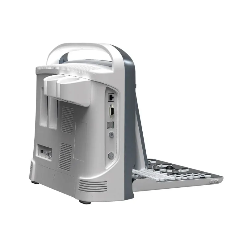 Chison Eco1 Ultrasound Machine - Image 3